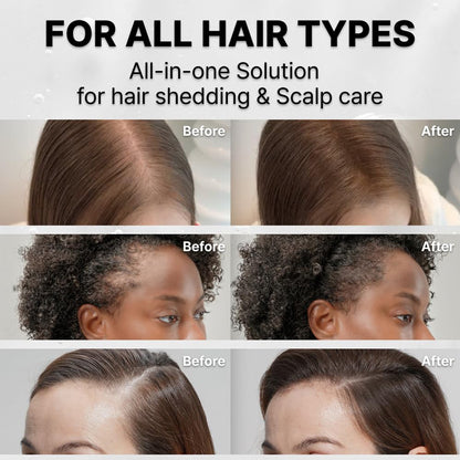 RootRevive™ Hair Growth Ampoule