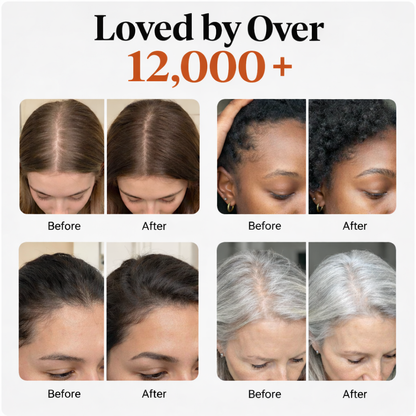 RootRevive™ Hair Growth Ampoule